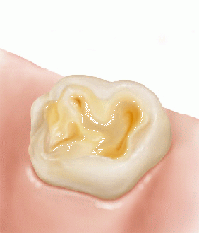 1436414591 erosion1